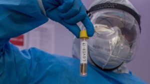 First COVID-19 patient who had undergone the plasma therapy, recovered
