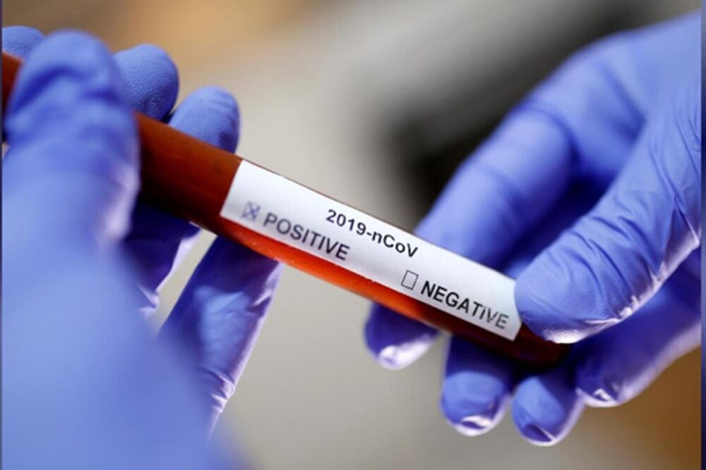 Representative Image of Coronavirus testing kit
