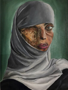 Acid attack: A Catastrophic Battle For Both The Genders