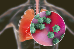 Coronavirus: Chennai hospital performs Asia's first bilateral lung transplant on covid survivor Coronavirus: Chennai hospital performs Asia’s first bilateral lung transplant on covid survivor
