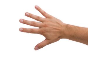 Sanguina, an Atlanta- based health Technology developer, wants to make fingernail selfies a digital biomarker for iron deficiency