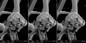 Explaining Black Fungus : The scary new disease that India is afraid of