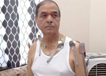 Doctors Thrashed The Claims Of A Man Developing Magnetic Properties