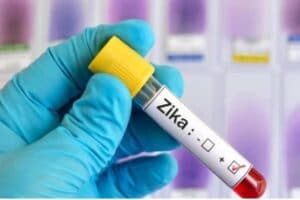 With 16 new Zika virus cases, Kanpur crosses the 100-mark.