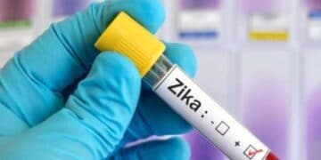 With 16 new Zika virus cases, Kanpur crosses the 100-mark.