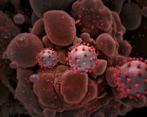Is a prolonged COVID a possibility with mild Omicron symptoms? Explained