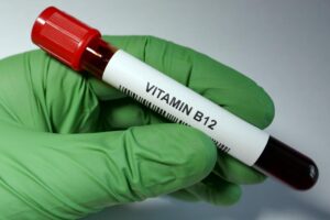 Vitamin B12 Deficiency: Know the Symptoms and Test