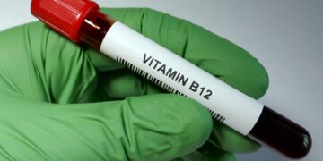 Vitamin B12 Deficiency: Know the Symptoms and Test