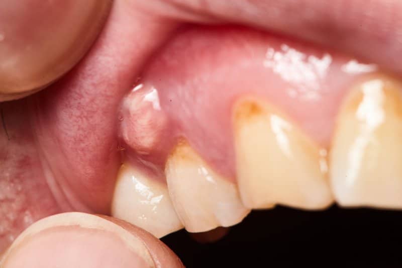 7 Most Common Dental Problems and Treatments