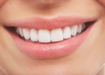 7 Most Common Dental Problems and Treatments