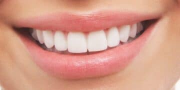 7 Most Common Dental Problems and Treatments