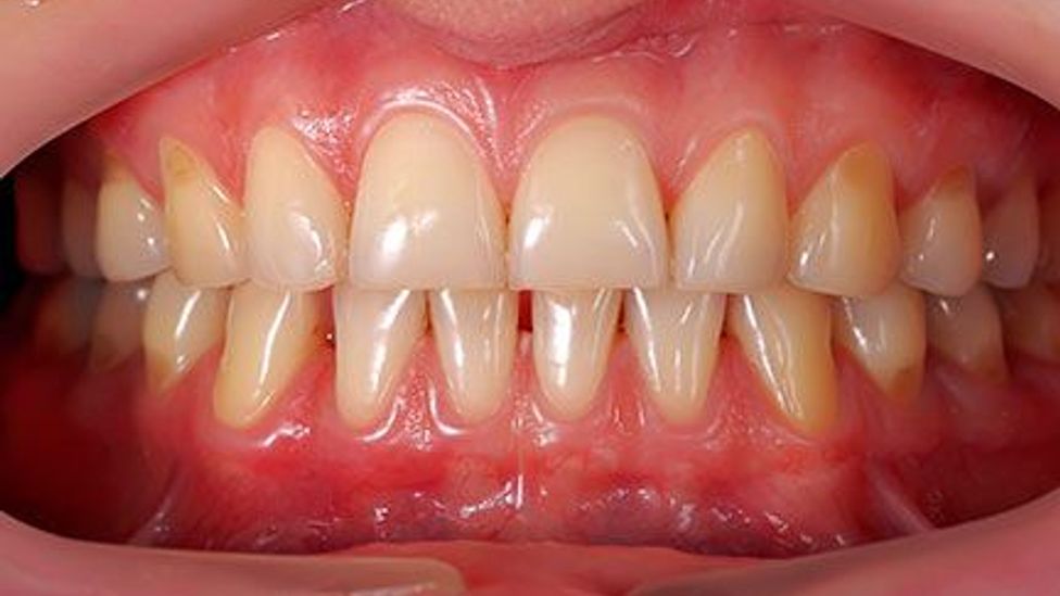 8 Most Common Dental Problems and Treatments