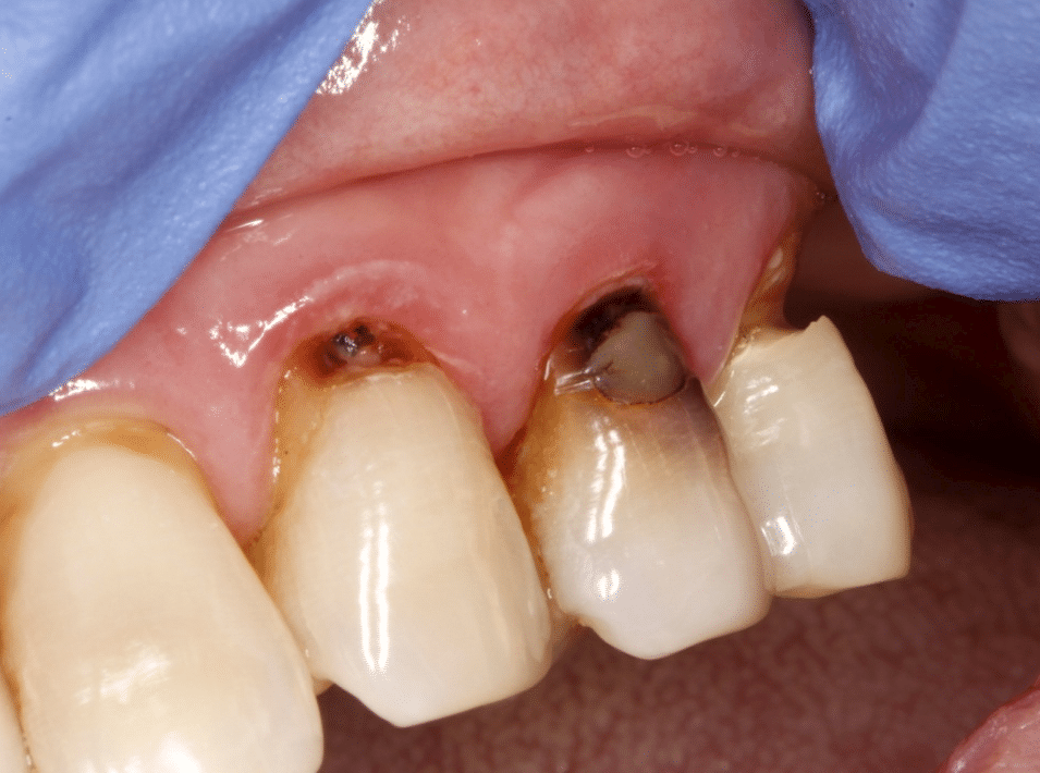 8 Most Common Dental Problems and Treatments