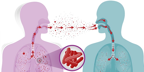 Lockdown Lifestyle Risks Youth of Tuberculosis Infections 