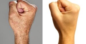 5 changes that prove humans are still evolving: