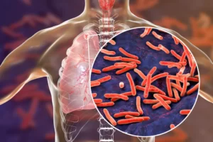 How has TB conquered your body?