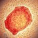 The Monkeypox Virus and its Recent Occurrence in the UK