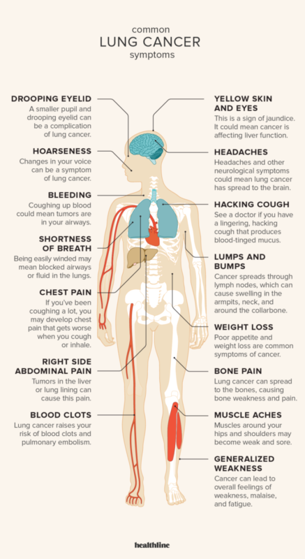 everything you need to know about lung cancer