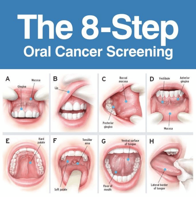 oral health