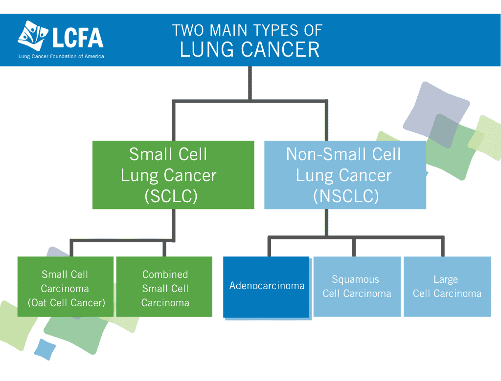 everything you need to know about lung cancer