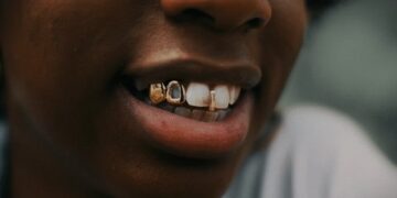 10 Unique Grillz Ideas