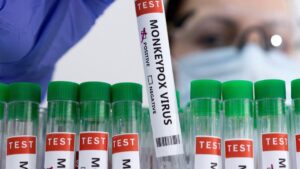 Pakistani health officials confirm first case of monkeypox