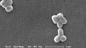 Explained | Abaucin, the potential new antibiotic found with machine-learning