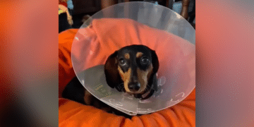Australian woman, Dachshund mauled by bull terrier weeks before wedding day