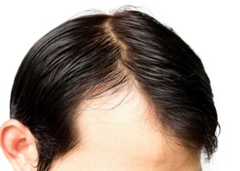 Look Like Peyton Manning? How to Sack Your Receding Hairline