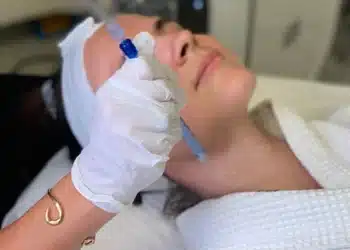 Unlocking Celestial Beauty: Stars Who Swear by JetPeel Facials