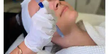 Unlocking Celestial Beauty: Stars Who Swear by JetPeel Facials